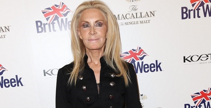 Joan Van Ark Didn't Admit Plastic Surgeries But We Find Some Difference